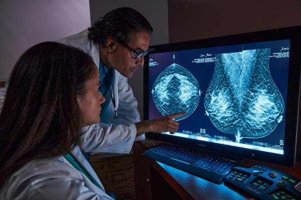 Radiologen beoordelen tomosynthesemammografie op een scherm.