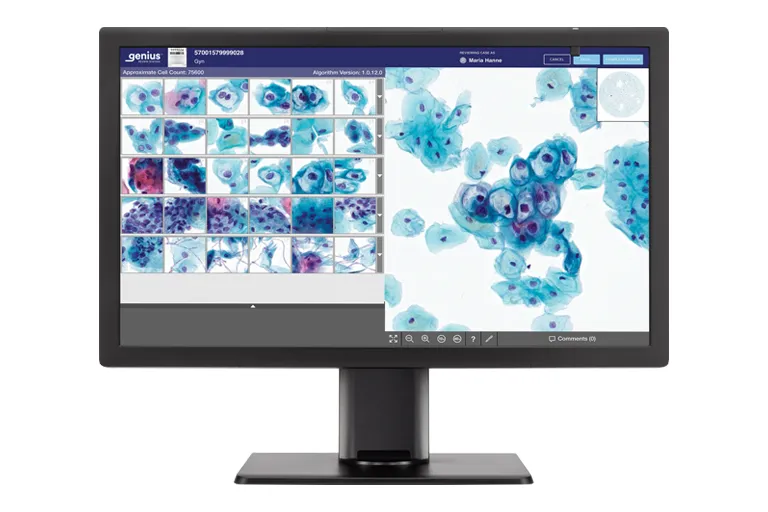 Genius-monitor toont cytologiecellen klaar voor beoordeling