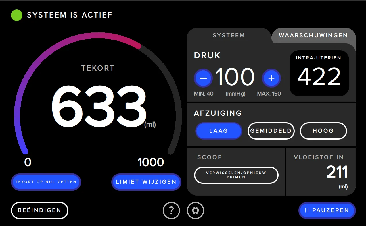 Screenshot van de gebruikersinterface van Fluent Pro Fluid Management Systeem waarop de druk wordt weergegeven.