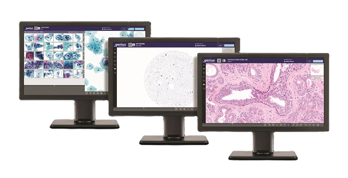Genius Review Station met diverse monstertypen (gynaecologisch, niet-gynaecologisch en histologie)