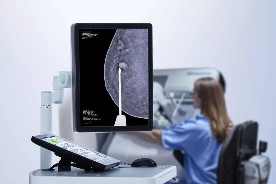 3D contrastmammografie op een computerscherm