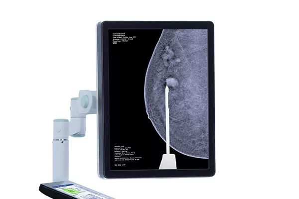 Affirm® software voor contrastbiopsie op witte achtergrond