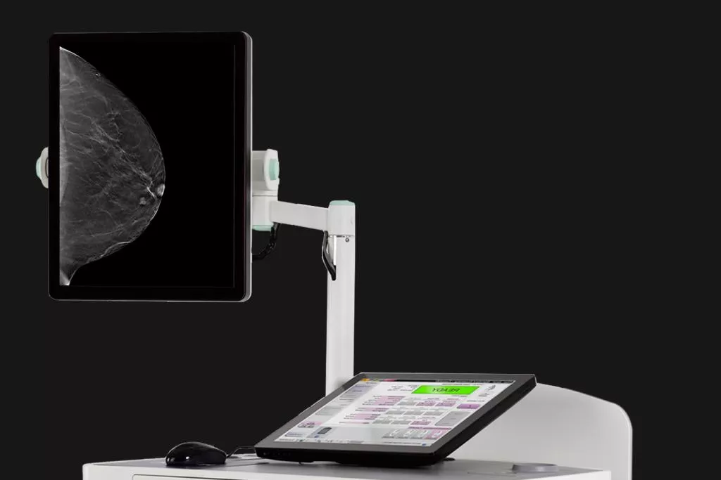 Medisch apparaat toont beeld van borstscan