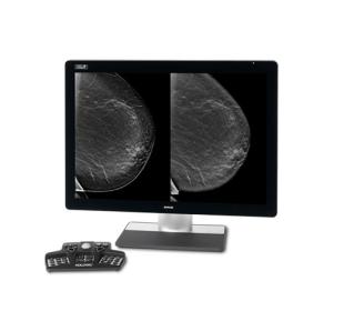 Hologic Intelligent 2D™ gesynthetiseerde beeldvorming op witte achtergrond