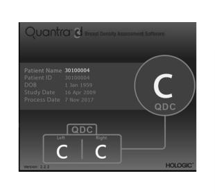 Hologic Quantra™ technologie op witte achtergrond