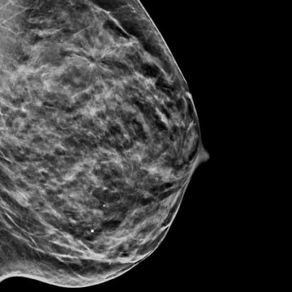Hologic C-View™ gesynthetiseerde 2D-beeldvorming op witte achtergrond